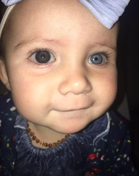 Ivy-Mae: One Year Old Cancer Warrior