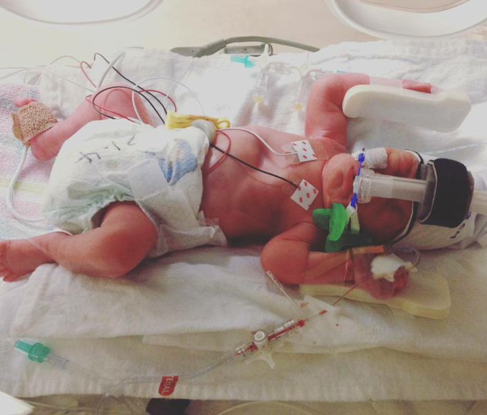 Going into labour at 30 weeks pregnant : from mucous plug to the final Code Zero