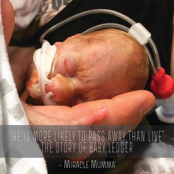 “He is more likely to pass away than live”: the story of baby Ledger